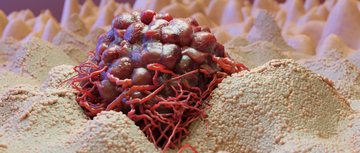 Cancer cell image