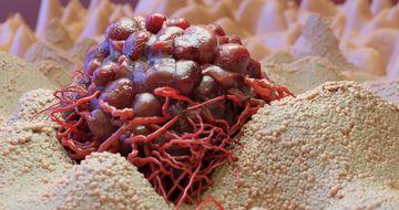 Cancer cell image