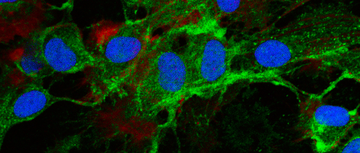 Mesenchymal stromal cells