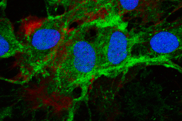 Mesenchymal stromal cells