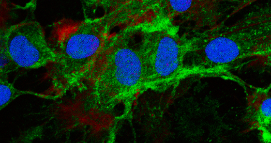 Mesenchymal stromal cells