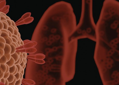 An image of a cancer cell and lungs in red