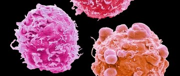 An image of colorectal cancer cells