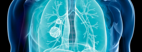 illustration of a man's lungs