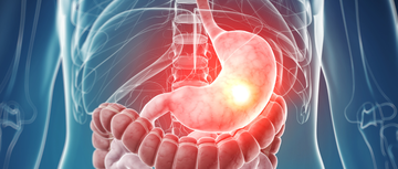 stomach cancer image