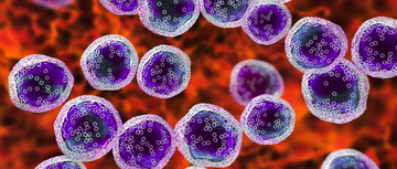 Large B-Cell Lymphoma