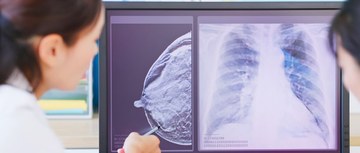 Woman pointing to x-ray of metastatic breast cancer diagram