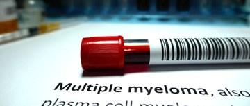 Multiple Myeloma