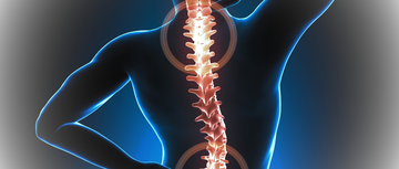 medical illustration of inflamation from osteoporosis